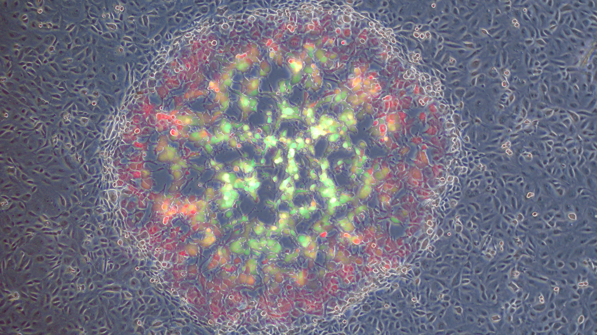 A plaque formed by the dual fluorescent reporter virus. Image: Supplied Detail of a plaque